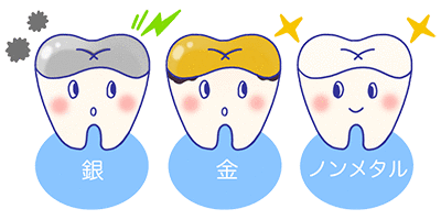 ノンメタルで行こう ノンメタルで行こう